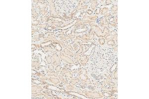 Immunohistochemical analysis of paraffin-embedded human kidney tissue using (ABIN1537780 and ABIN2848638) performed on the Leica® BOND RXm. (RAB28 anticorps  (AA 119-147))