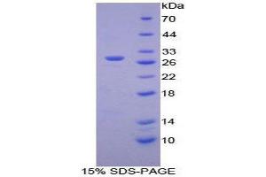 SDS-PAGE (SDS) image for Hexosaminidase A (HEXA) (AA 319-528) protein (His tag) (ABIN2125195)