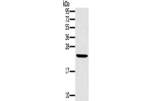 Gel: 12 % SDS-PAGE, Lysate: 40 μg, Lane: Mouse liver tissue, Primary antibody: ABIN7130217(MED22 Antibody) at dilution 1/800, Secondary antibody: Goat anti rabbit IgG at 1/8000 dilution, Exposure time: 15 seconds (MED22 anticorps)