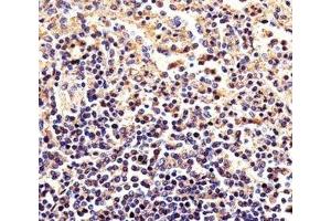 Immunohistochemical analysis of paraffin-embedded human spleen using beta-Actin antibody at 1:25 dilution.