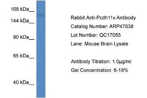 Western Blotting (WB) image for anti-Protocadherin 11 (PCDH11) (Middle Region) antibody (ABIN2782817) (PCDH11X anticorps  (Middle Region))