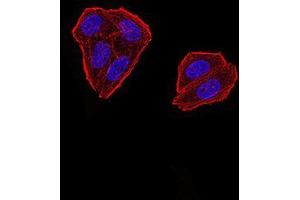 Immunofluorescence analysis of Hela cells using ZFP91 mouse mAb. (ZFP91 anticorps  (AA 162-304))