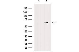 Western blot analysis of extracts from HUVEC, using CDC25C Antibody.
