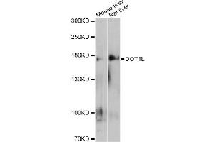 Western blot analysis of extracts of various cell lines, using DOT1L antibody (ABIN6292029) at 1:500 dilution.