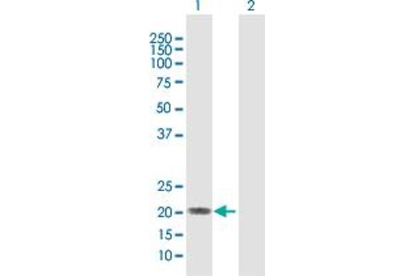 IFNA5 antibody  (AA 1-189)