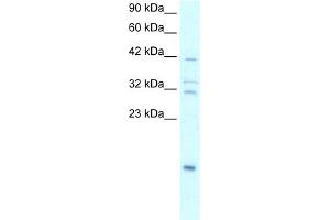 WB Suggested Anti-NFKBIA Antibody Titration:  0.