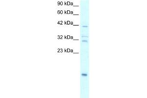 WB Suggested Anti-NFKBIA Antibody Titration:  0. (NFKBIA anticorps  (N-Term))