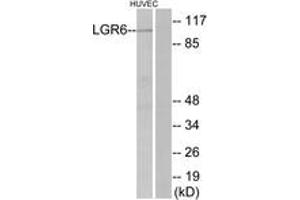 Western blot analysis of extracts from HuvEc cells, using LGR6 Antibody. (LGR6 anticorps  (AA 471-520))