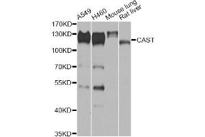 Western blot analysis of extracts of various cell lines, using CAST antibody (ABIN6290228) at 1:1000 dilution. (Calpastatin anticorps)