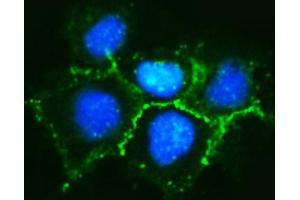 IF analysis of delta 1 Catenin/CAS/CTNND1 using anti-delta 1 Catenin/CAS/CTNND1 antibody (ABIN7602221). (CTNND1 anticorps  (AA 64-930))