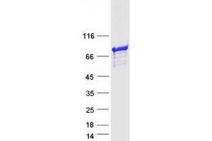 Validation with Western Blot