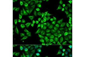 Immunofluorescence analysis of A549 cells using ABAT Polyclonal Antibody (ABAT anticorps)