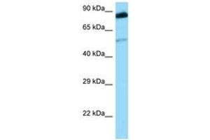 Image no. 1 for anti-Src-Related Kinase Lacking C-Terminal Regulatory Tyrosine and N-Terminal Myristylation Sites (SRMS) (AA 211-260) antibody (ABIN6748403) (SRMS anticorps  (AA 211-260))