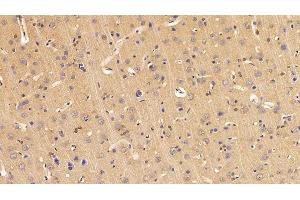 Detection of ADPN in Rat Cerebrum Tissue using Polyclonal Antibody to Adiponectin (ADPN) (ADIPOQ anticorps  (AA 111-244))