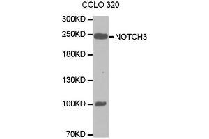 Western blot analysis of extracts of COLO 320 cells lines, using NOTCH3 antibody. (NOTCH3 anticorps  (AA 751-850))