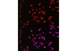 Immunofluorescence analysis of Neuro-2a cells using CHRM1 Rabbit pAb (ABIN3022210, ABIN3022211, ABIN3022212, ABIN1512760 and ABIN6218670) at dilution of 1:200 (40x lens).