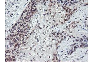 Image no. 10 for anti-Protein Phosphatase 1, Regulatory (Inhibitor) Subunit 15A (PPP1R15A) antibody (ABIN1498364)