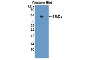 Detection of Recombinant LXRa, Mouse using Polyclonal Antibody to Liver X Receptor Alpha (LXRa) (NR1H3 anticorps  (AA 93-432))