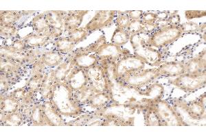 Detection of TNC in Rat Kidney Tissue using Polyclonal Antibody to Tenascin C (TNC)