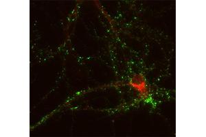 Immunofluorescence labeling of cultured hippocampus neurons (dilution 1 : 1000; red). (Neurobeachin anticorps  (AA 952-1320))