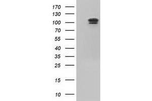 HEK293T cells were transfected with the pCMV6-ENTRY control (Left lane) or pCMV6-ENTRY USP5 (Right lane) cDNA for 48 hrs and lysed. (USP5 anticorps)