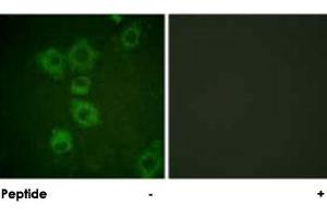 Immunofluorescence analysis of HUVEC cells, using CASP6 polyclonal antibody . (Caspase 6 anticorps)