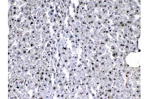 IHC analysis of VEGF Receptor 3 using anti-VEGF Receptor 3 antibody .