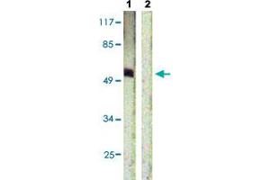 Western blot analysis of Lane 1: HepG2 cells, Lane 2: antigen-specific peptide treated HepG2 cells with ETS1 (phospho T38) polyclonal antibody  at 1:500-1:1000 dilution. (ETS1 anticorps  (pThr38))