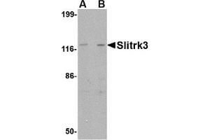 Western blot analysis of Slitrk3 in SK-N-SH cell lysate with AP30802PU-N Slitrk3 antibody at (A) 0. (SLITRK3 anticorps  (C-Term))