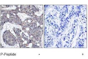 Image no. 1 for anti-Heat Shock 27kDa Protein 1 (HSPB1) (pSer82) antibody (ABIN197004) (HSP27 anticorps  (pSer82))
