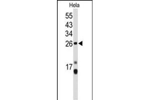 Western blot analysis of CENPH Antibody (Center) (ABIN653160 and ABIN2842728) in Hela cell line lysates (35 μg/lane). (CENPH anticorps  (AA 136-162))
