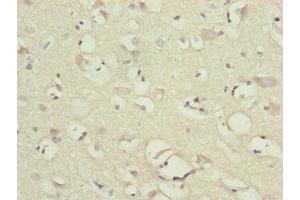 Immunohistochemistry of paraffin-embedded human brain tissue using ABIN7160914 at dilution of 1:100 (NDUFB1 anticorps  (AA 1-172))
