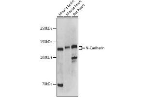 Western blot analysis of extracts of various cell lines, using N-Cadherin antibody (ABIN1684127, ABIN1514384, ABIN5663657 and ABIN6213846) at 1:500 dilution.