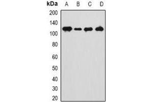 Western blot analysis of ANKRD28 expression in Hela (A), HT1080 (B), mouse kidney (C), mouse testis (D) whole cell lysates. (ANKRD28 anticorps)
