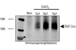 Image no. 5 for anti-Hypoxia Inducible Factor 1, alpha Subunit (Basic Helix-Loop-Helix Transcription Factor) (HIF1A) (AA 432-528) antibody (ABIN363317) (HIF1A anticorps  (AA 432-528))