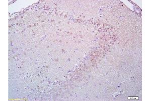 Formalin-fixed and paraffin embedded rat brain tissue labeled with Anti-Brdu Polyclonal Antibody, Unconjugated  at 1:200, followed by conjugation to the secondary antibody and DAB staining