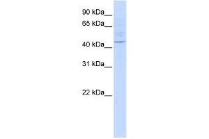 WB Suggested Anti-LAX1 Antibody Titration:  0. (LAX1 anticorps  (Middle Region))