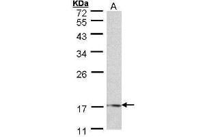 WB Image Sample (30 ug of whole cell lysate) A: 293T 12% SDS PAGE antibody diluted at 1:500 (LMO1 anticorps)