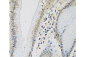 Immunohistochemistry of paraffin-embedded Human stomach using CCL26 Polyclonal Antibody at dilution of 1:200 (40x lens). (CCL26 anticorps)