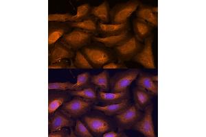 Immunofluorescence analysis of U-2 OS cells using  antibody (ABIN7265407) at dilution of 1:100.
