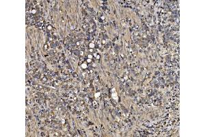 IHC analysis of ATG9A using anti-ATG9A antibody (ABIN7600676). (ATG9A anticorps  (AA 22-169))