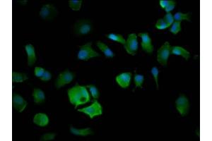 Immunofluorescence staining of MCF-7 cells with ABIN7151584 at 1:200, counter-stained with DAPI. (ELP4 anticorps  (AA 117-223))