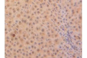 IHC-P analysis of Rat Liver Tissue, with DAB staining. (PARK7/DJ1 anticorps  (AA 1-189))