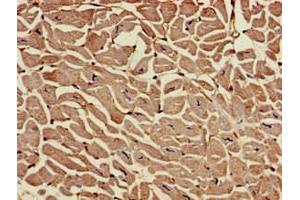 Immunohistochemistry of paraffin-embedded human heart tissue using ABIN7167819 at dilution of 1:100