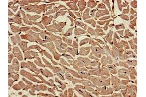 Immunohistochemistry of paraffin-embedded human heart tissue using ABIN7167819 at dilution of 1:100 (RAI1 anticorps  (AA 617-823))