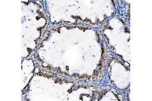 IHC analysis of TBX18 using anti-TBX18 antibody (ABIN7599494).