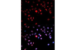 Immunofluorescence analysis of MCF7 cell using Phospho-CREB1-S133 antibody.
