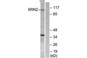 Western blot analysis of extracts from COS7 cells, using XRN2 Antibody.