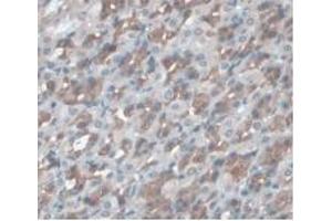DAB staining on IHC-P; Samples: Rat Stomach Tissue (ORM1 anticorps  (AA 20-186))