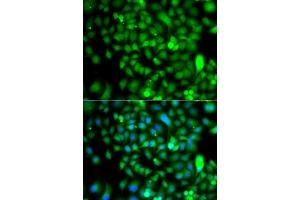 Immunofluorescence analysis of  cells using CSRP2BP antibody (ABIN6127664, ABIN6139138, ABIN6139139 and ABIN6223242). (CSRP2BP anticorps  (AA 523-782))